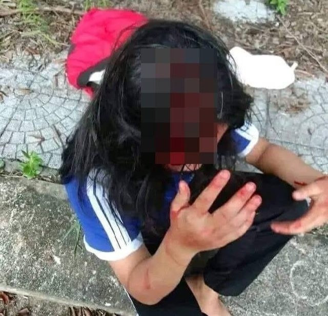  Không mua nước uống dùm bạn, 1 nữ sinh lớp 8 bị đánh toác đầu: Ngày 17/9, Công an xã Lộc Thủy phối hợp với Ban Giám hiệu Trường THCS Lộc Thủy (huyện Phú Lộc, Thừa Thiên-Huế) làm việc với phụ huynh và các nữ sinh đánh nhau. L.A đã dùng tay, gậy đánh tới tấp vào người và đầu em H.L, bạn học cùng lớp. Trong khi L.A đánh H.L thì có một số bạn nữ khác đi tìm dùi, gậy gần đó đưa cho L.A. Ngoài ra, một nữ sinh khác cũng xông vào giật tóc H.L. khiến em này bị chảy nhiều máu ở vùng đầu. Nguyên nhân vụ việc được xác định là do H.L. không mua nước uống dùm L.A. nên xảy ra mâu thuẫn.