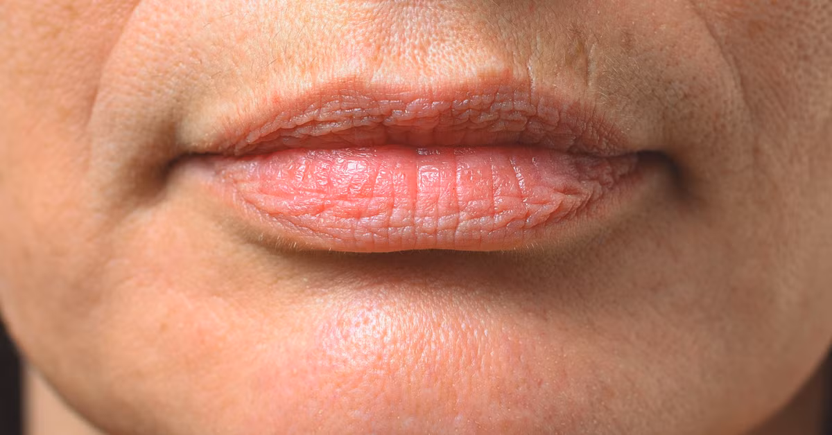 LẦM TƯỞNG: Môi bạn khôn bao giờ bị cháy nắng. SỰ THẬT: Mọi người thường không chú ý tới điều này nhưng sự thật là đôi môi hoàn toàn có thể bị cháy nắng và tổn thương dưới ánh nắng mặt trời. Bởi vậy, khi chọn lựa các sản phẩm dưỡng môi, bạn nên cân nhắc các loại kem có đặc điểm chống tia UV.