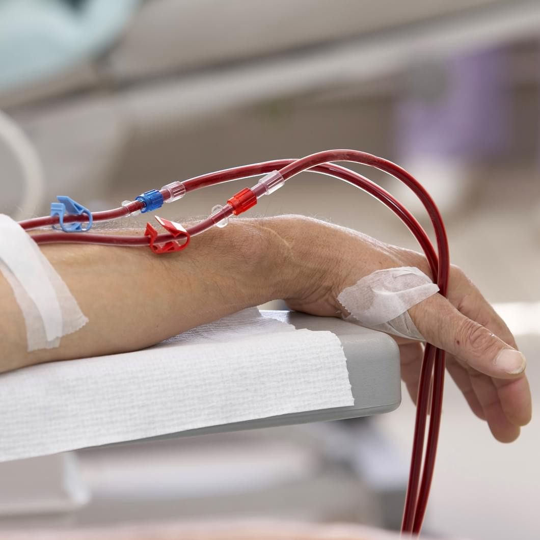 Nhung bien chung khi chay than nhan tao nguoi benh can biet-Hinh-6