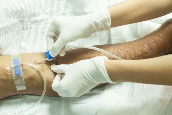 Nhung bien chung khi chay than nhan tao nguoi benh can biet-Hinh-7