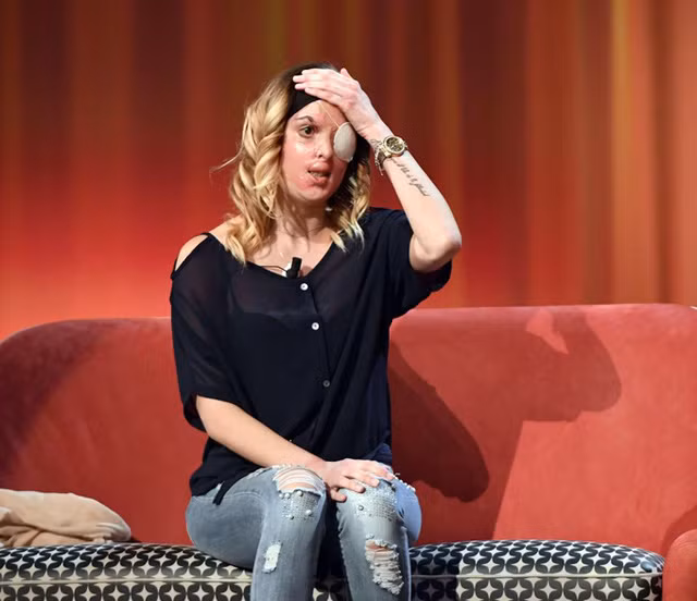 Nu hoang sac dep Italy bien dang mat vi bi tat a xit