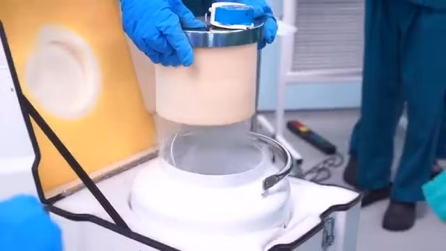 Vinmec ap dung thanh cong ky thuat ghep xuong tu than cho benh nhan ung thu xuong-Hinh-3