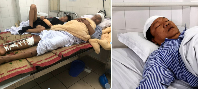  Khởi tố vụ án truy sát dã man 3 ngư dân trên biển: Công an huyện Tiên Lãng (Hải Phòng) khởi tố vụ án hình sự Cố ý gây thương tích xảy ra tại khu vực biển Cồn Nam, xã Vinh Quang, huyện Tiên Lãng, khiến 2 ngư dân bị thương nặng. Trước đó, một nhóm đối tượng đi trên 2 ca nô áp sát và xông lên thuyền dùng dao kiếm, gậy gộc gây thương tích, khiến nạn nhân sợ hãi phải nhảy xuống biển. Sau đó dùng kiếm chém liên tiếp vào hai nạn nhân khác trên bờ.