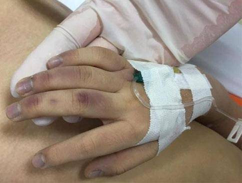 Theo khai nhận của L.T.C, trưa 16/9, anh ta dạy con gái học. Do A chậm tiếp thu nên C giận dữ, dùng đũa, thanh tre và cán chổi đánh con. Khoảng 16h cùng ngày, mẹ cháu A cho cháu ăn cháo và uống 1 viên Paradol thì cháu nôn nhiều, nên đã đưa cháu vào Bệnh viện Nhi Trung ương cấp cứu. Tại đây, các bác sĩ cho biết, cháu A đã tử vong trước khi vào bệnh viện.