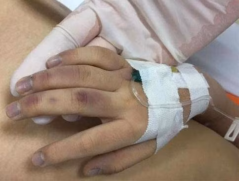 Theo khai nhận của L.T.C, trưa 16/9, anh ta dạy con gái học. Do A chậm tiếp thu nên C giận dữ, dùng đũa, thanh tre và cán chổi đánh con. Khoảng 16h cùng ngày, mẹ cháu A cho cháu ăn cháo và uống 1 viên Paradol thì cháu nôn nhiều, nên đã đưa cháu vào Bệnh viện Nhi Trung ương cấp cứu. Tại đây, các bác sĩ cho biết, cháu A đã tử vong trước khi vào bệnh viện.