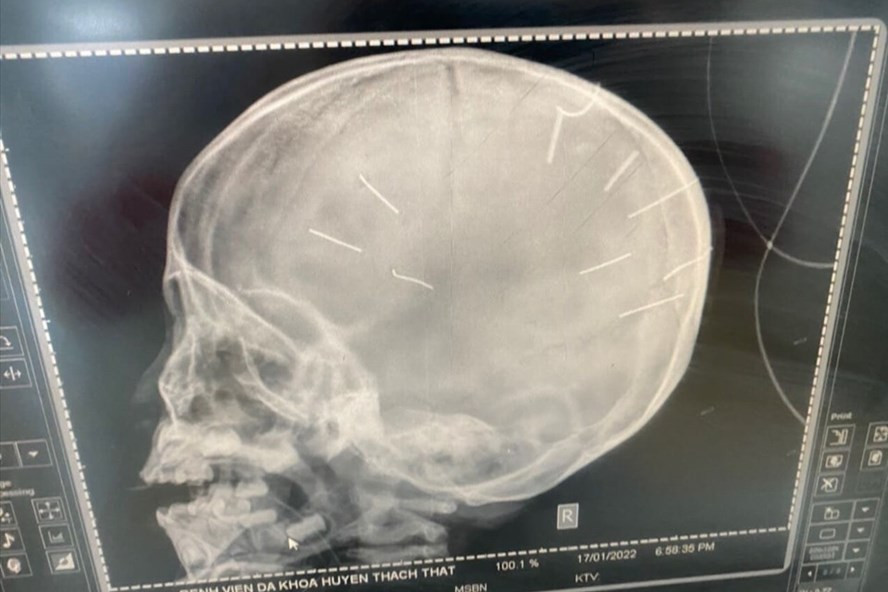 Nhung vu bao hanh tre em rung dong du luan