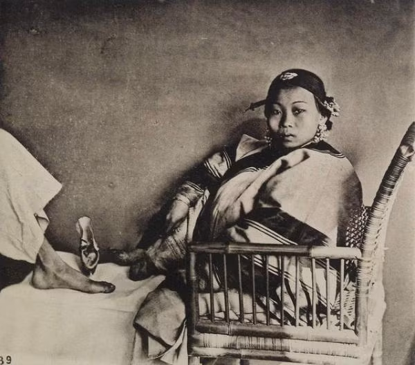 Người phụ nữ Trung Quốc này so sánh chiếc chân bị bó của mình với chân một người bình thường, năm 1868. Ảnh tư liệu.