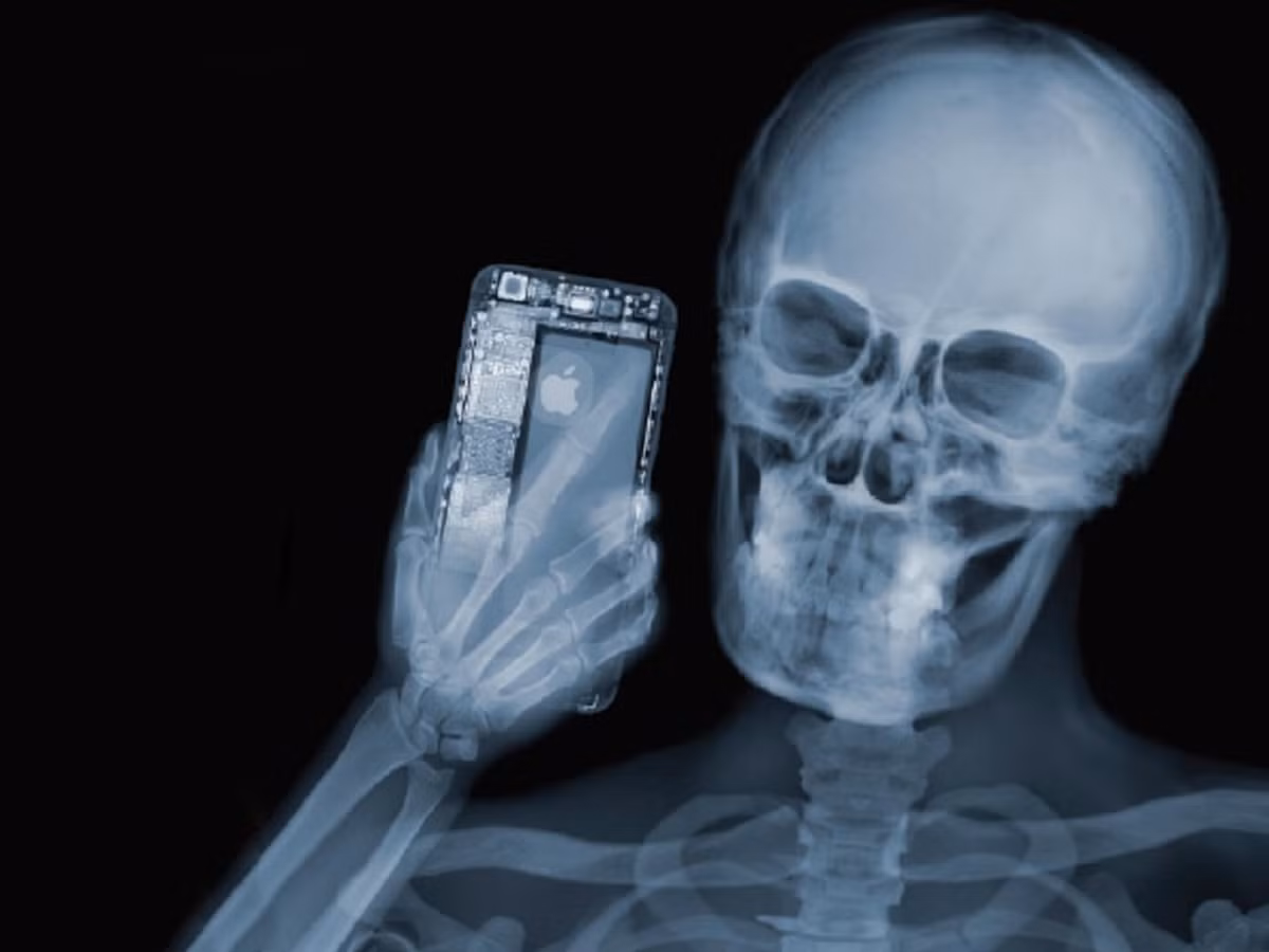 Tia X là gì, nó được phát hiện như thế nào? - Hình 2 Tia X la gi, no duoc phat hien nhu the nao?-Hinh-2