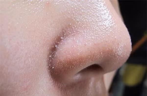 Moi khi rua mat lam dieu nay se khong bao gio bi lai mun cam-Hinh-2