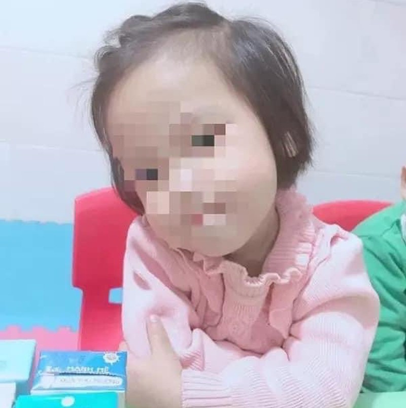 Toàn cảnh vụ bé gái 3 tuổi tử vong do bị đóng đinh vào đầu - Hình 2 Toan canh vu be gai 3 tuoi tu vong do bi dong dinh vao dau-Hinh-2
