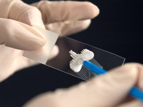 Đặc biệt, phụ nữ nên thường xuyên kiểm tra sức khỏe sinh sản như xét nghiệm cổ tử cung để bảo vệ chính mình.