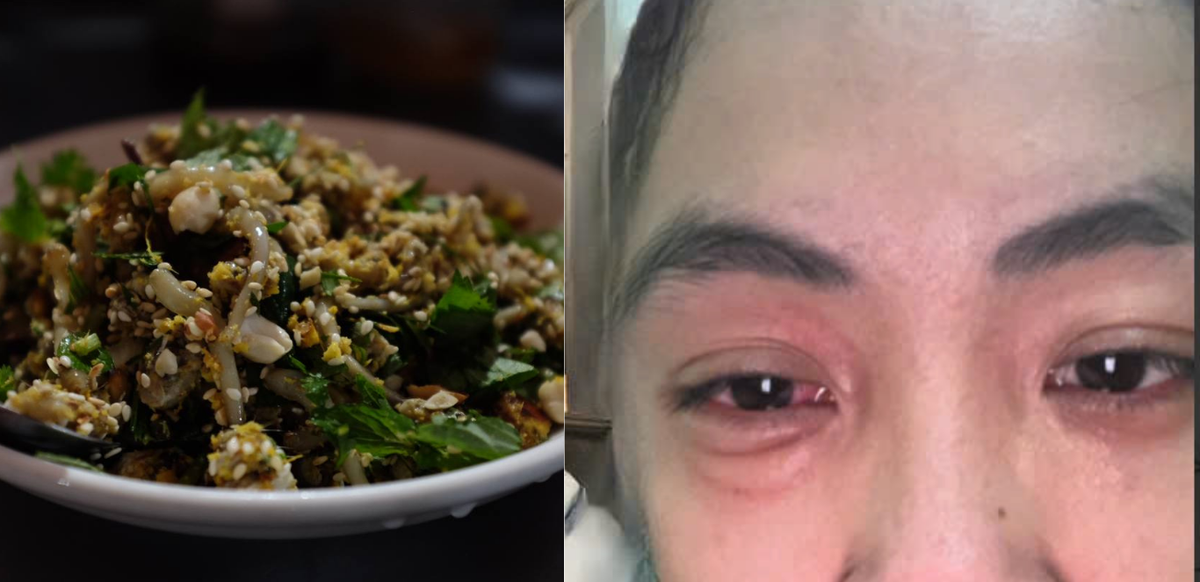 Tuy nhiên, không phải ai cũng thưởng thức đặc sản "chân dài" này được bởi một số người thưởng thức xong gặp tình trạng dở khóc dở cười mắt sưng húp, mẩn ngứa đầy người. Ảnh Đông Chí