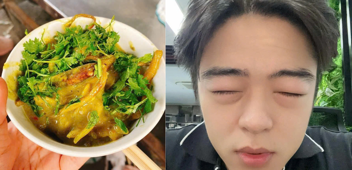 Cũng như các loại dị ứng hay gặp khác như dị ứng hải sản hay dị ứng phấn hoa, nguyên nhân dẫn đến phản vệ có thể là do trong cơ thể giá bể có các thành phần protein lạ. Khi ăn vào cơ thể, với một số người sẽ sinh ra kháng thể, chất trung gian hóa học phản ứng rất mạnh mẽ với các protein lạ này gây tình trạng phản vệ. Ảnh Trần Văn Mạnh