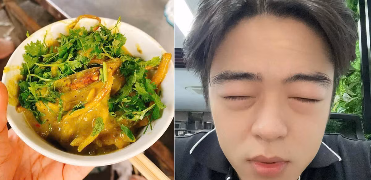 Cũng như các loại dị ứng hay gặp khác như dị ứng hải sản hay dị ứng phấn hoa, nguyên nhân dẫn đến phản vệ có thể là do trong cơ thể giá bể có các thành phần protein lạ. Khi ăn vào cơ thể, với một số người sẽ sinh ra kháng thể, chất trung gian hóa học phản ứng rất mạnh mẽ với các protein lạ này gây tình trạng phản vệ. Ảnh Trần Văn Mạnh