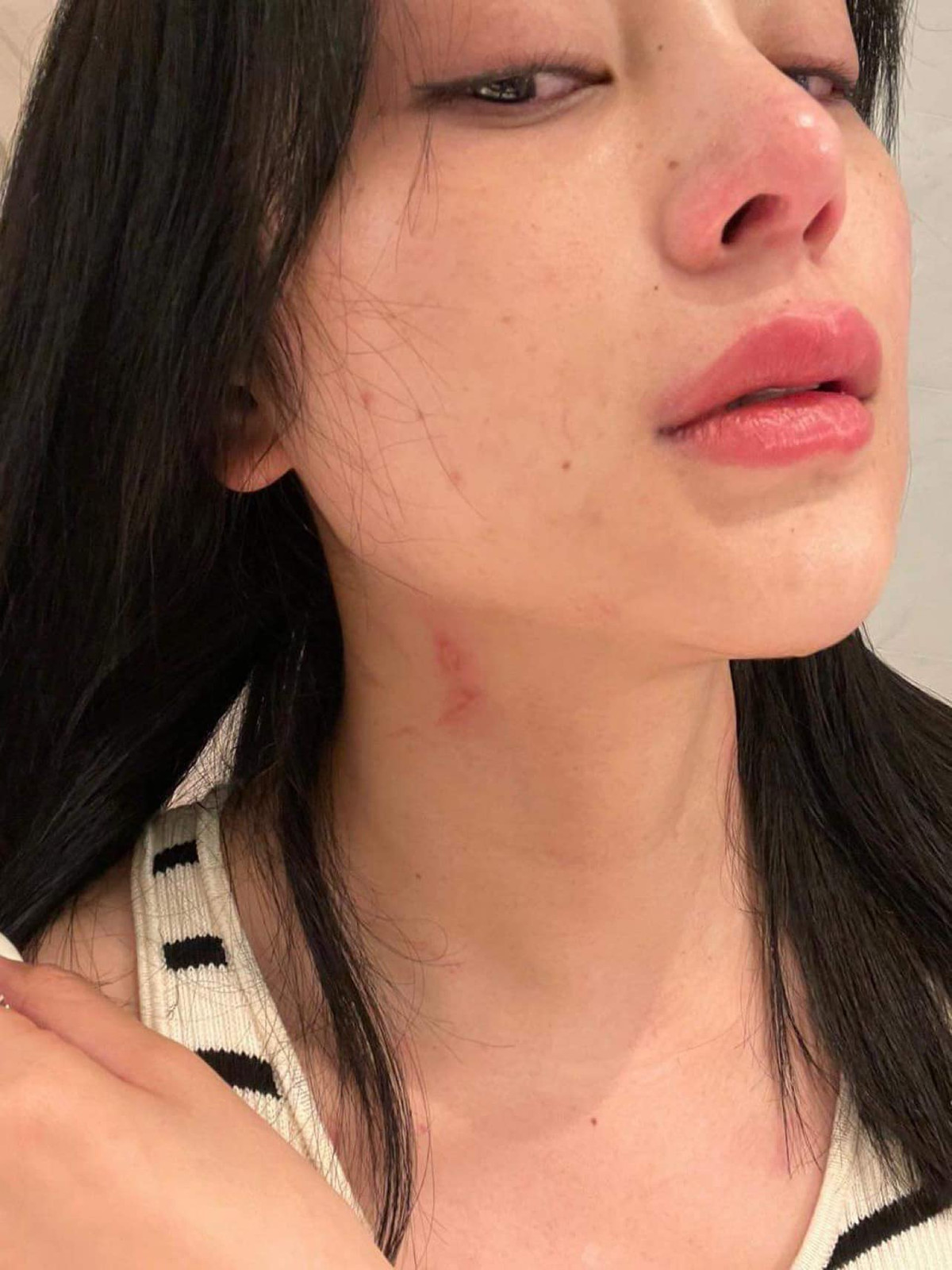 Về phía Lily Chen, sau màn "cà khịa" nữ hoàng nội y, cô nàng tung loạt ảnh bị hành hung, ám chỉ có người hãm hại.