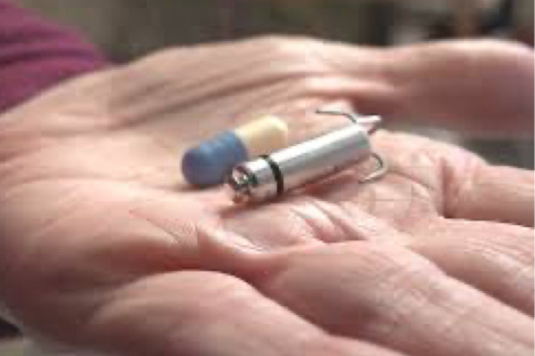 Viet Nam cay thanh cong may tao nhip tim khong day nho nhu vien thuoc con nhong