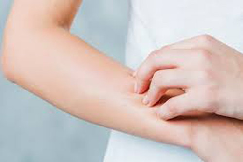 Mắc tiểu đường, người bệnh cũng có dấu hiệu ngứa da. Nghiên cứu chỉ ra, hiện tượng ngứa này thường thấy ở giai đoạn đầu khởi phát, hơn 30% người bị ngứa da.