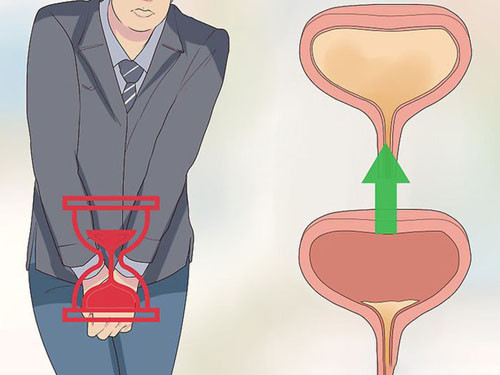 Ngoài ra, giữ lượng lớn nước tiểu trong bàng quang quá lâu sẽ làm tăng nguy cơ bị lây nhiễm vi khuẩn có hại trong nước tiểu, gây ra hàng loạt chứng nhiễm trùng đường tiết niệu hoặc bàng quang. Bàng quang kết nối với hệ tiết niệu, bao gồm thận qua một ống dẫn. Do đó, việc giữ nước tiểu lâu còn dễ dẫn tới nguy cơ sỏi thận.