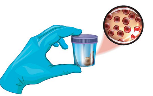 28 tuoi ung thu dai truc trang vi thoi quen nhieu nguoi mac-Hinh-2