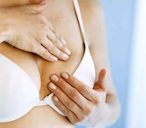 Những hiểu lầm “ngây ngô” về bệnh ung thư vú - Hình 2 Nhung hieu lam “ngay ngo” ve benh ung thu vu-Hinh-2