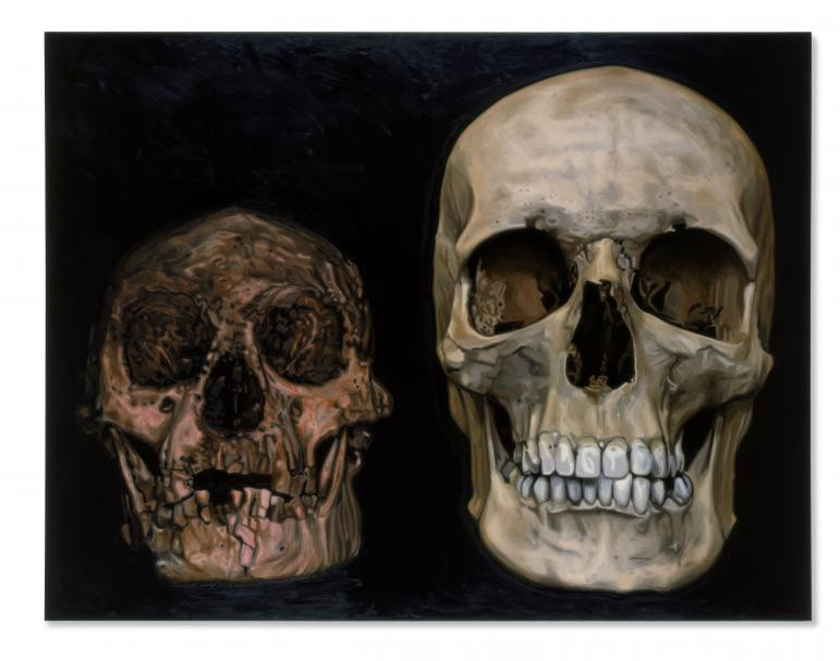 Việc 2 chủng người cùng xuất hiện tại một địa điểm và cùng thời điểm được cho chính là lý do người Homo floresiensis biến mất trong khi người hiện đại - chủng Homo sapiens tiếp tục phát triển. Video: Kỳ lạ: Người phụ nữ ‘lùn đi trông thấy’ (nguồn: VTC14)