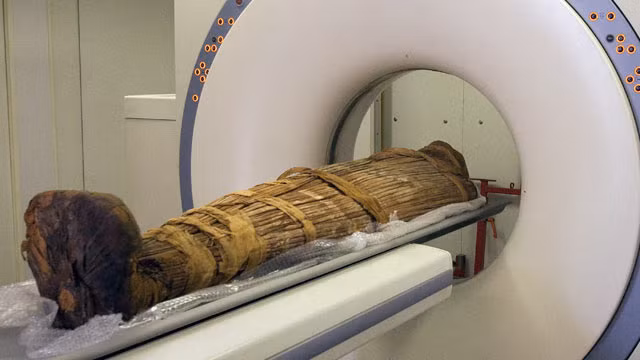 Ba trong số 5 xác ướp cổ xưa trên được cho là tử vong vì viêm phổi, 1 người được cho là chết vì suy thận. Người cuối cùng qua đời vì một nguyên nhân không xác định. Bốn trong số 5 người trên sống ở Nam Mỹ và người còn lại sống ở Ai Cập.