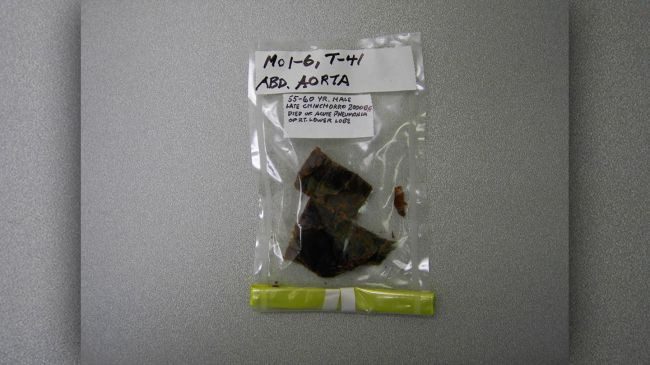 Ông Madjid và các cộng sự là những người đầu tiên sử dụng phương pháp quang phổ hấp thụ cận hồng ngoại để phát hiện cholesterol trong xác ướp.