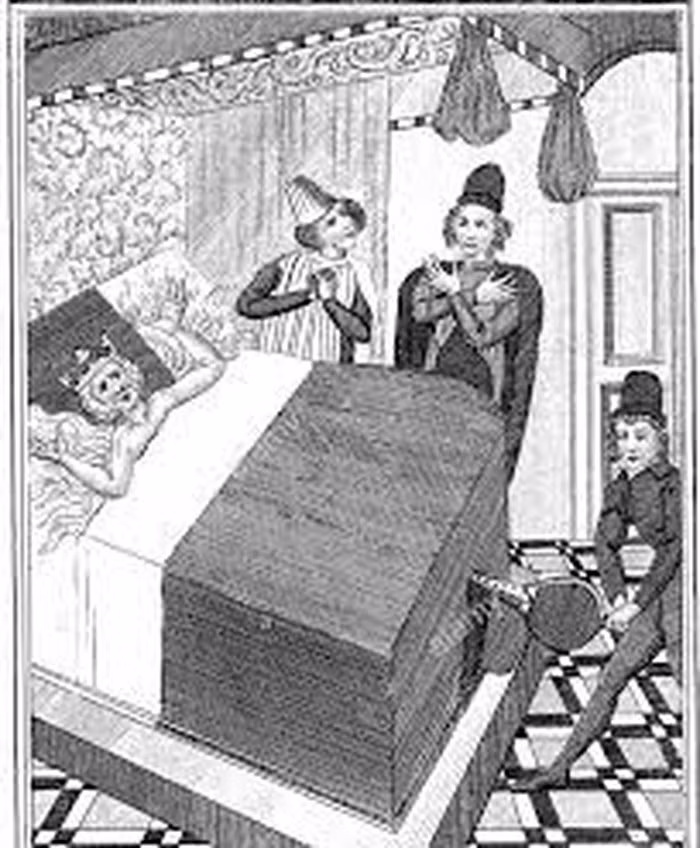 Chính vì vậy, bác sĩ quyết định dùng nến đốt cháy sợi chỉ thừa. Điều không ai ngờ đến là tấm vải lanh ngâm rượu dễ dàng bắt lửa từ ngọn nến.