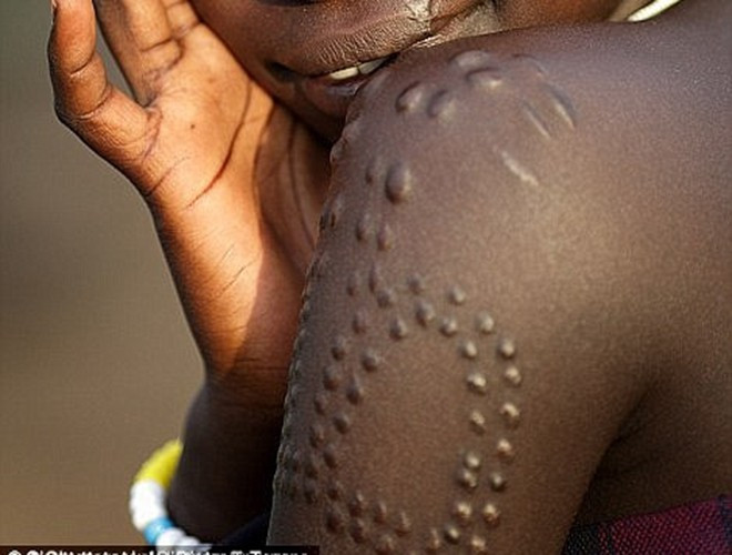 Tại Cộng hòa Sudan hay một số bộ lạc khác trên thế giới, tạo vân trên cơ thể là một cách làm đẹp nhiều người ưa chuộng. Những đường vân rõ nét, vằn vện sẽ làm nổi bật nét đẹp thu hút của con người