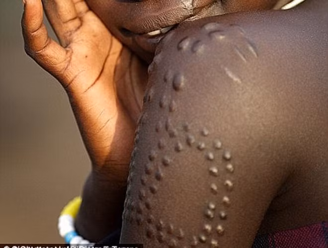 Tại Cộng hòa Sudan hay một số bộ lạc khác trên thế giới, tạo vân trên cơ thể là một cách làm đẹp nhiều người ưa chuộng. Những đường vân rõ nét, vằn vện sẽ làm nổi bật nét đẹp thu hút của con người