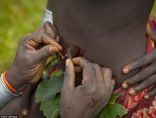 Để tạo ra các đường vân đẹp nhất, người "làm đẹp" phải chịu đau đớn và đổ nhiều máu. Họ dùng gai chọc vào da và lấy dao lam cắt đi. Sau khi vết thương lành, chỗ cắt sẽ tạo ra phần sẹo lồi như hình vẽ phác họa trước đó
