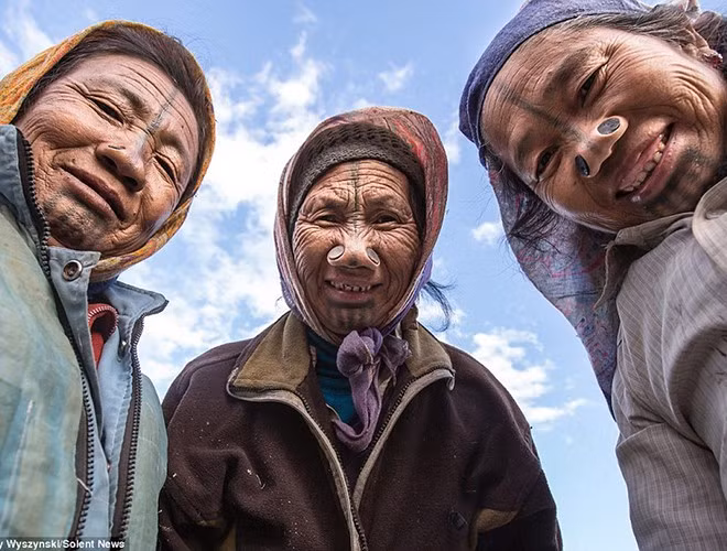 Ngay từ khi còn nhỏ, các cô bé Apatani đã được cha mẹ đục rồi nhét những đồng xu vào cánh mũi. Theo thời gian, chiếc nút cũng lớn dần theo tuổi của người phụ nữ, tạo nên hình dạng mũi trông rất kì quặc