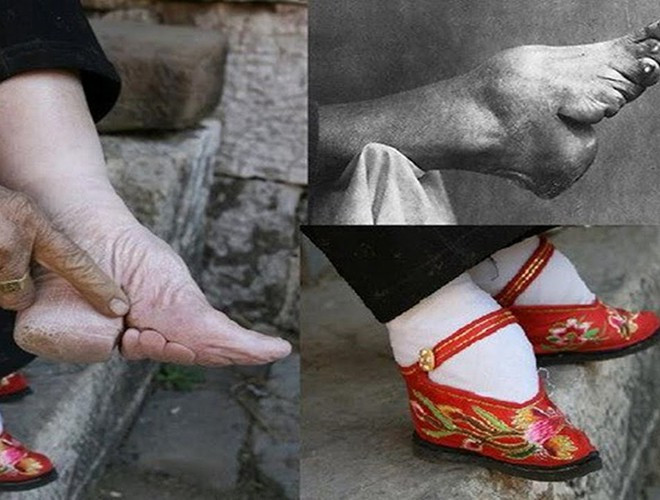 Bó chân là một tập tục của phụ nữ Trung Quốc trong khoảng thời gian dài hàng nghìn năm, trải qua nhiều triều đại phong kiến. Phong tục này bắt nguồn từ thế kỉ X, khi quan niệm thời bấy giờ cho rằng, phụ nữ phải có một đôi chân thật bé (khoảng 9 cm) thì mới lấy được chồng