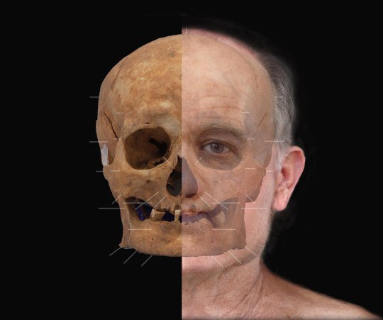 Kết quả cho thấy người đàn ông Scotland chết cách đây 600 năm bị hói đầu, đôi mắt xanh và chiểu cao cơ thể khoảng 159 - 166 cm.