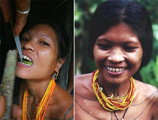 Hàm răng sau khi mài sẽ gần giống như hàm cá mập với những chiếc răng nhọn hoắt. Khi răng đã có một độ nhọn nhất định, họ được coi là đã trưởng thành và sẵn sàng kết hôn.