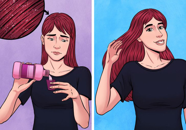 Dùng nước súc miệng để trị gàu: Nếu không tìm được loại dầu gội trị gàu như ý, bạn có thể tham khảo nước súc miệng. Khi thực hiện, bạn pha loãng dung dịch theo tỉ lệ 1:1, nhẹ nhàng massage da đầu. Để nguyên như vậy vài phút rồi mới gội sạch, thành phần cồn trong nước súc miệng sẽ loại bỏ hết gàu “cứng đầu”.