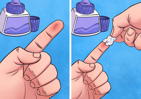 Lấy dằm tay bằng keo dán thủ công: Bị dằm đâm tay sẽ rất khó chịu. Thay vì dùng kim để lẩy ra thì bạn có thể tận dụng keo dán thủ công. Bạn cần chọn được loại keo tốt, có màu trắng và dễ khô. Khi thực hiện, bạn đổ lượng keo phù hợp vào chỗ có dằm và đợi khô. Tiến hành bóc lớp keo khô, chiếc dằm sẽ cùng chúng đi ra, giúp giảm cảm giác khó chịu.