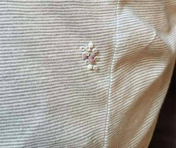 Đặc biệt, bọ xít khi đẻ trứng trên quần áo sẽ để lại chất dính khó phát hiện, khó giặt sạch. Nếu không may tiếp xúc trực tiếp với dịch chứa axit này rất dễ gây bỏng da.