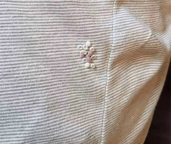 Đặc biệt, bọ xít khi đẻ trứng trên quần áo sẽ để lại chất dính khó phát hiện, khó giặt sạch. Nếu không may tiếp xúc trực tiếp với dịch chứa axit này rất dễ gây bỏng da.