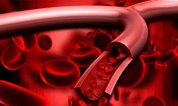 Đồng thời, gừng có khả năng cải thiện tốc độ lưu thông máu, kích thích chuyển hóa axit trong dạ dày, thúc đẩy nhu động đường tiêu hóa, rất tốt để khởi đầu ngày mới.