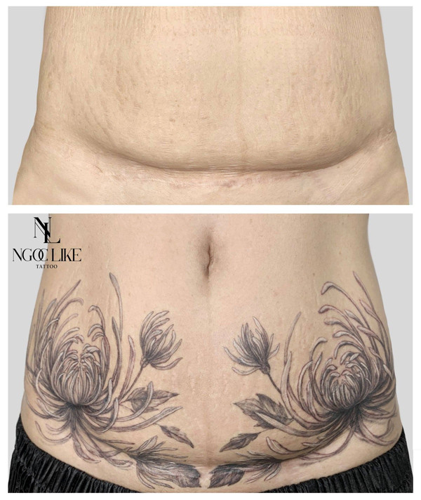 Bài toán khó hơn nữa là làm sao để hình xăm thật hài hòa, nhìn tự nhiên nhất có thể, người khác nhìn vào không nhận ra đối phương dùng hình xăm che sẹo. Kỳ diệu hơn, ngay cả bản thân chính chủ cũng dần quên đi vết sẹo cũ.