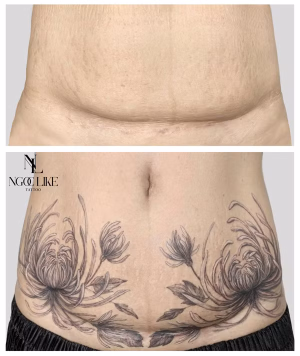 Bài toán khó hơn nữa là làm sao để hình xăm thật hài hòa, nhìn tự nhiên nhất có thể, người khác nhìn vào không nhận ra đối phương dùng hình xăm che sẹo. Kỳ diệu hơn, ngay cả bản thân chính chủ cũng dần quên đi vết sẹo cũ.