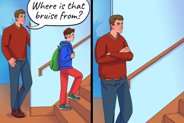 Bầm tím không rõ nguyên nhân: Trẻ con hiếu động khó tránh khỏi vấp ngã gây bầm tím. Vậy nhưng, nếu trẻ thường xuyên bị thương, bầm dập không rõ nguyên nhân thì có thể đây là dấu hiệu trẻ bị bắt nạt. Trước sự đe dọa của kẻ mạnh, trẻ không dám nói cho người lớn biết, chỉ âm thầm chịu đựng.