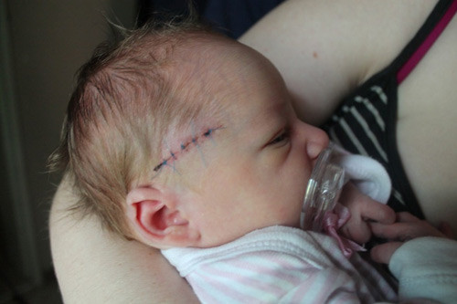 Thuong tam nhung tre so sinh bi bac si mo de trung nguoi-Hinh-5