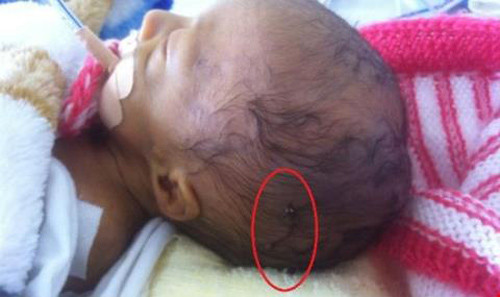 Thuong tam nhung tre so sinh bi bac si mo de trung nguoi