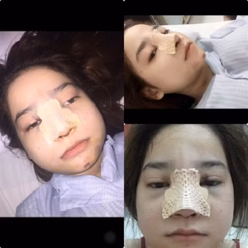 Năm 2013 Thảo đã quyết định chi tiền cho việc phẫu thuật thẩm mỹ, cấu tạo lại khuôn mặt của mình. Dù gặp sự phản đối của gia đình và bạn bè, cộng thêm việc thấy nhiều bạn gái thẩm mỹ hỏng, không được như ý khiến cô rất lo lắng. Tuy nhiên, phút cuối Thảo vẫn quyết tâm thay đổi bản thân mình.