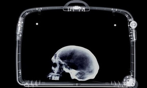 Sọ Người. Năm 2013, khi kiểm tra hành lý của hành khách tại sân bay ở Ft. Lauderdale, Florida, Mỹ, an ninh hàng không đã soi thấy những mảnh vỡ từ hộp sọ người chết lẫn trong những chậu hoa được nung từ đất sét. Theo Cục Quản lý An ninh Vận tải Mỹ (TSA), các mảnh sọ người này không gây nguy hiểm cho chuyến bay, nhưng nó lại được coi là bằng chứng của một vụ án.