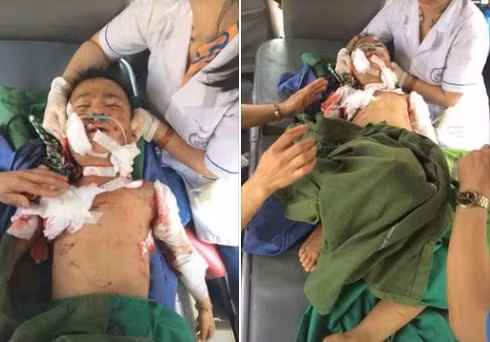 Kinh hoang be trai 7 tuoi bi cho can tu vong