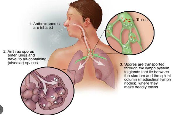Khi nao benh than co ty le tu vong len den 90%?