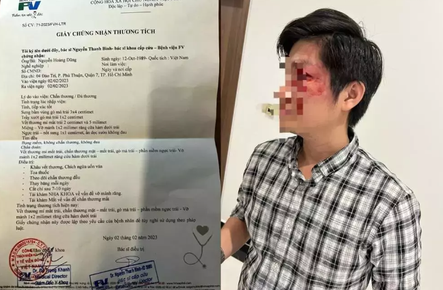 Chu cho hanh hung nguoi cha bao ve con doi mat hinh phat nao?